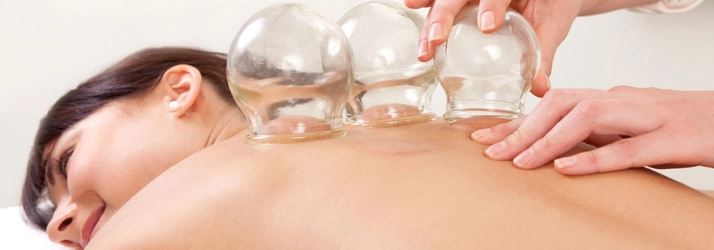 Chiropractic Lafayette IN Cupping On Back Chiropractic Lafayette IN Cupping On Back